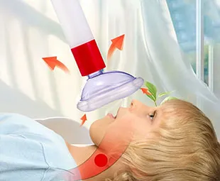 Fast Airway Clearance